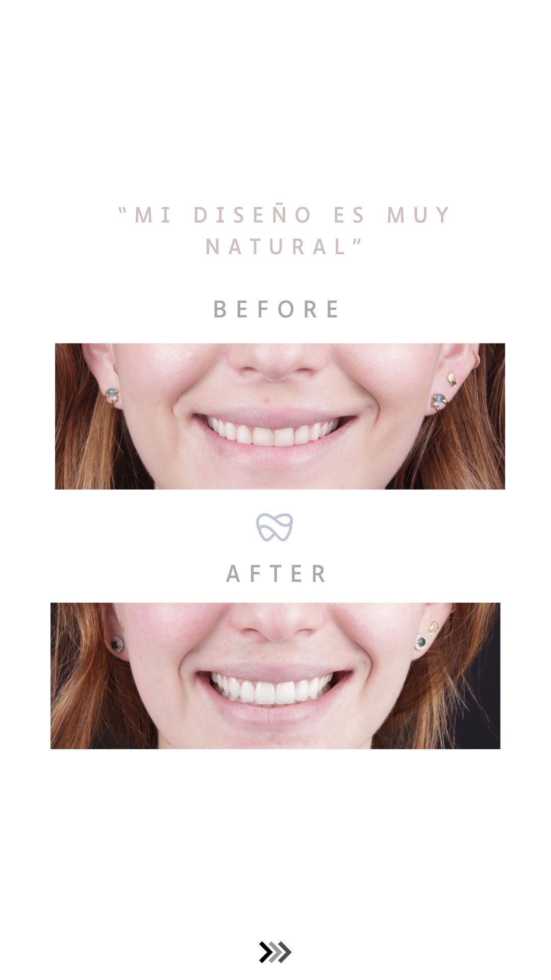 Erick Perea Santillán-8