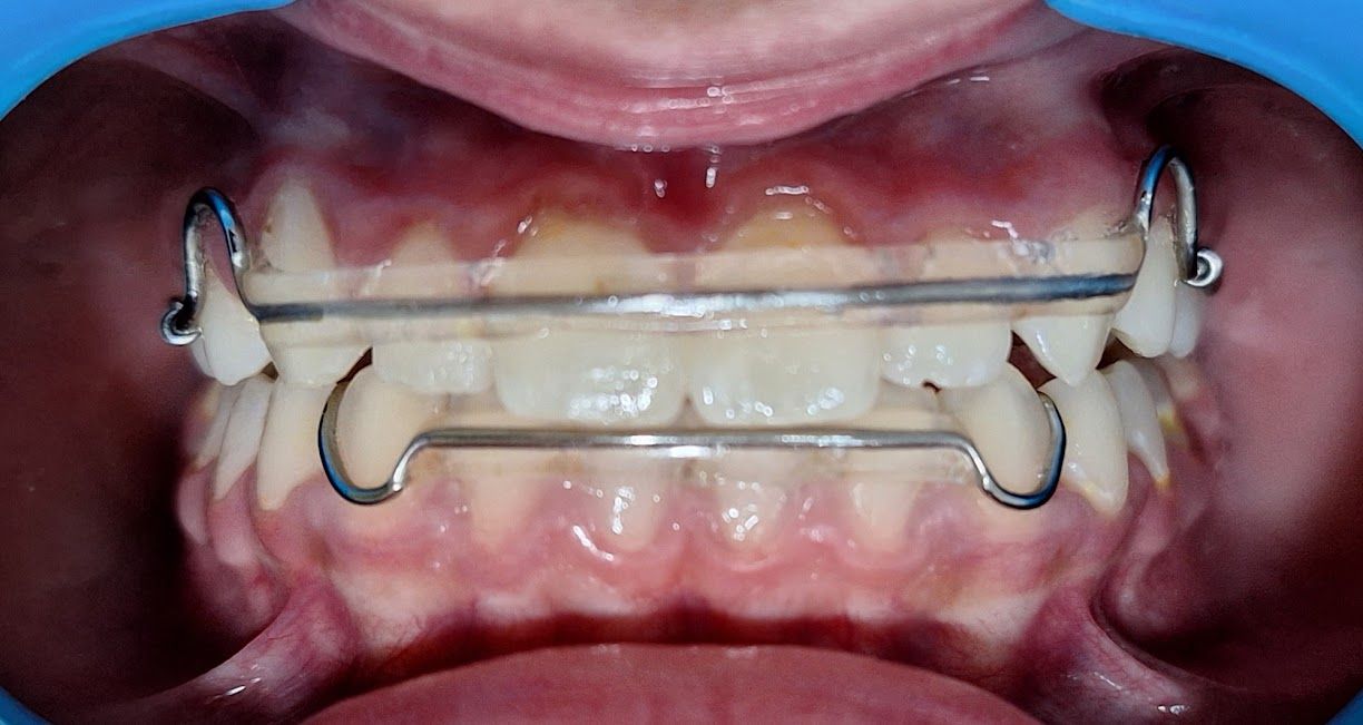 Gloria Itzel Cervantes Pavon-1