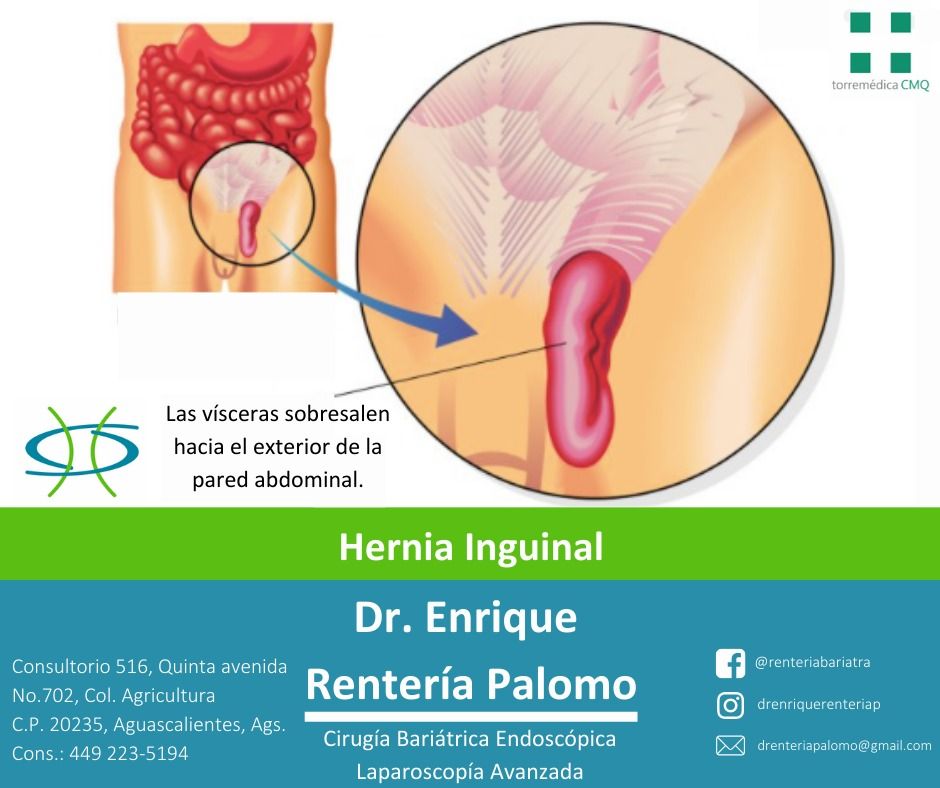 Enrique Rentería Palomo-17