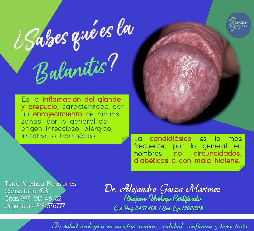 Alejandro Garza Martinez-44