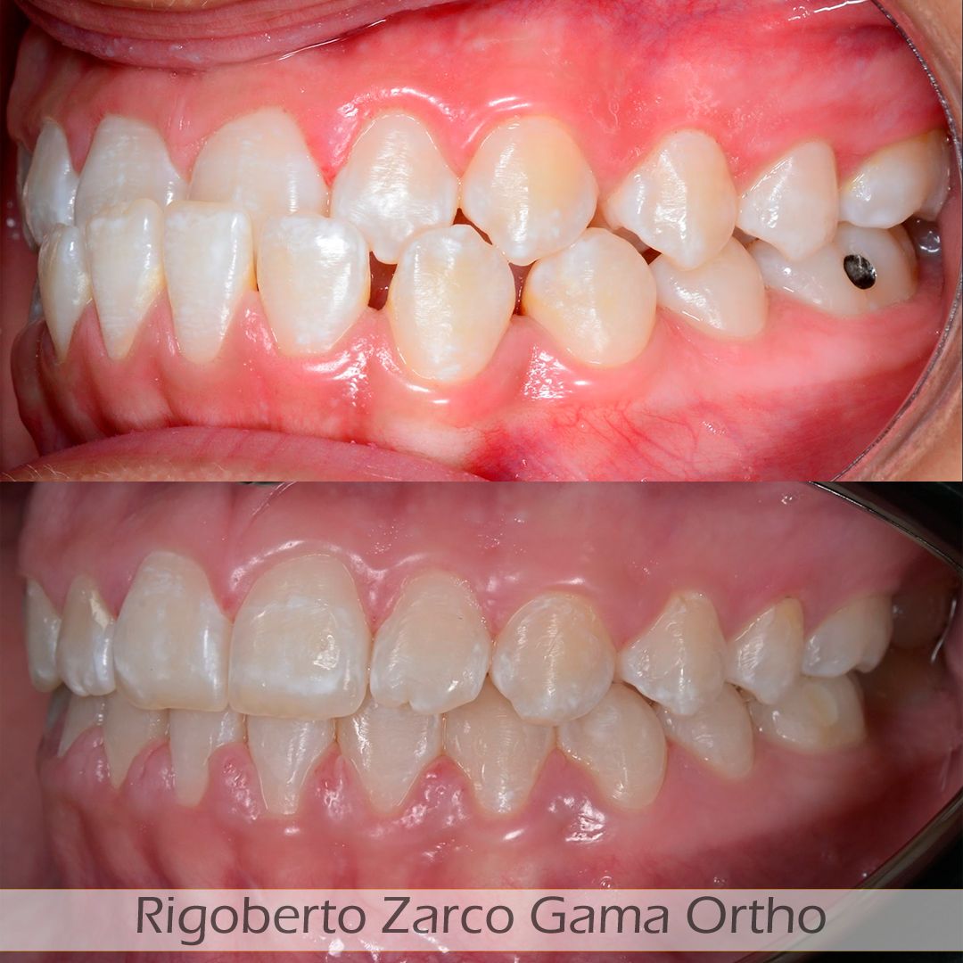 Rigoberto  Zarco Gama-7