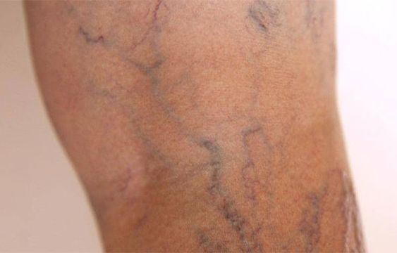 Erika Berenice Ramírez Pérez-18