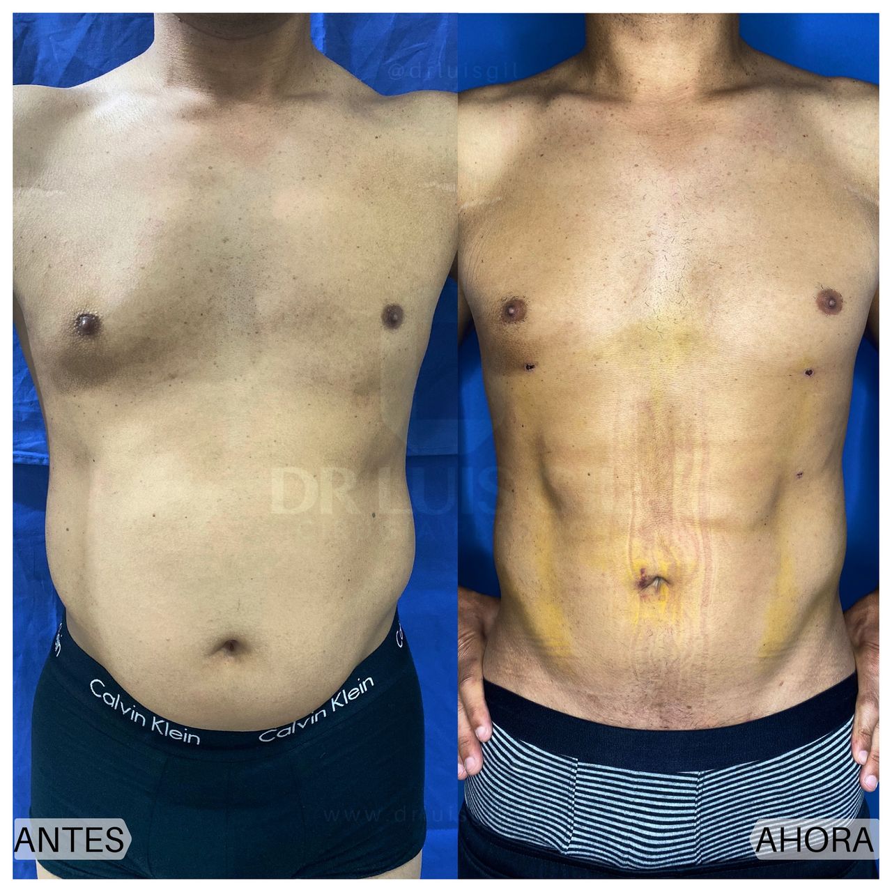 Luis Atilio Gil Pérez-5