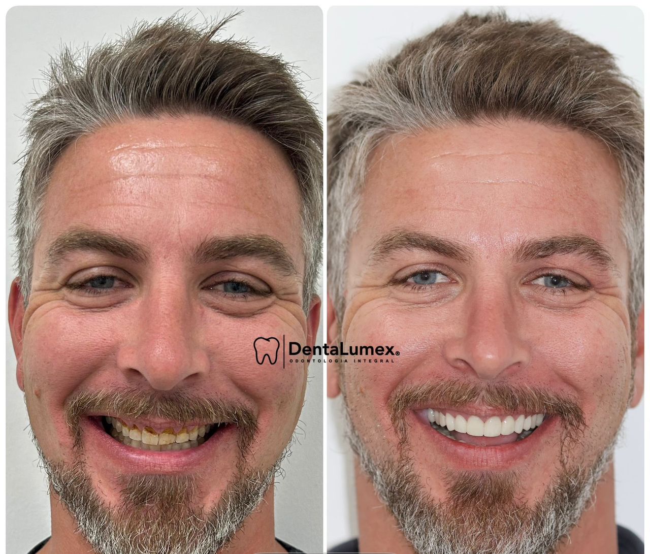 Nidya Irasema Gutierrez Garza-1