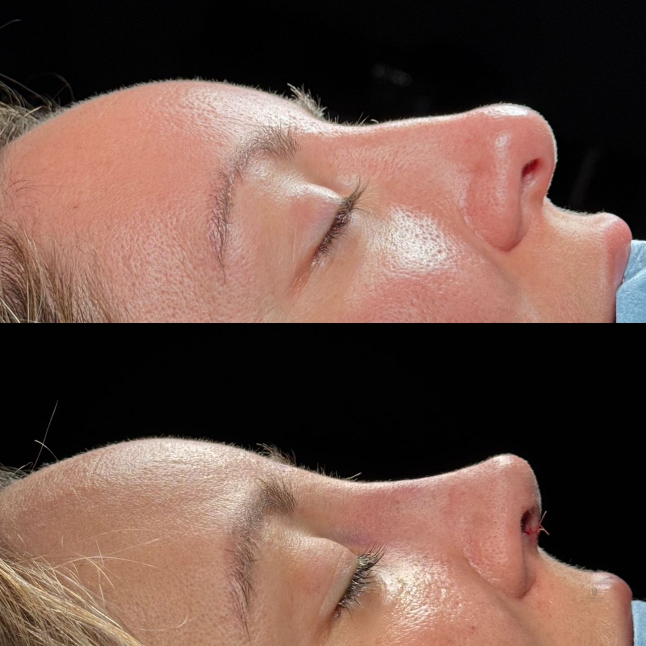 Angel Castro Urquizo-218