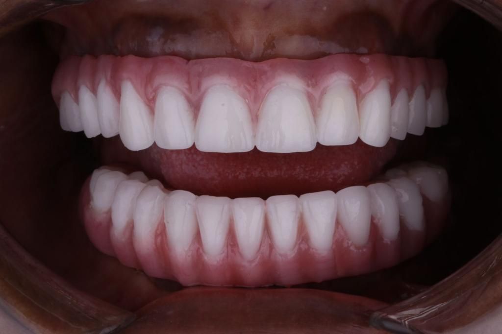 Josué Márquez Gómez-44