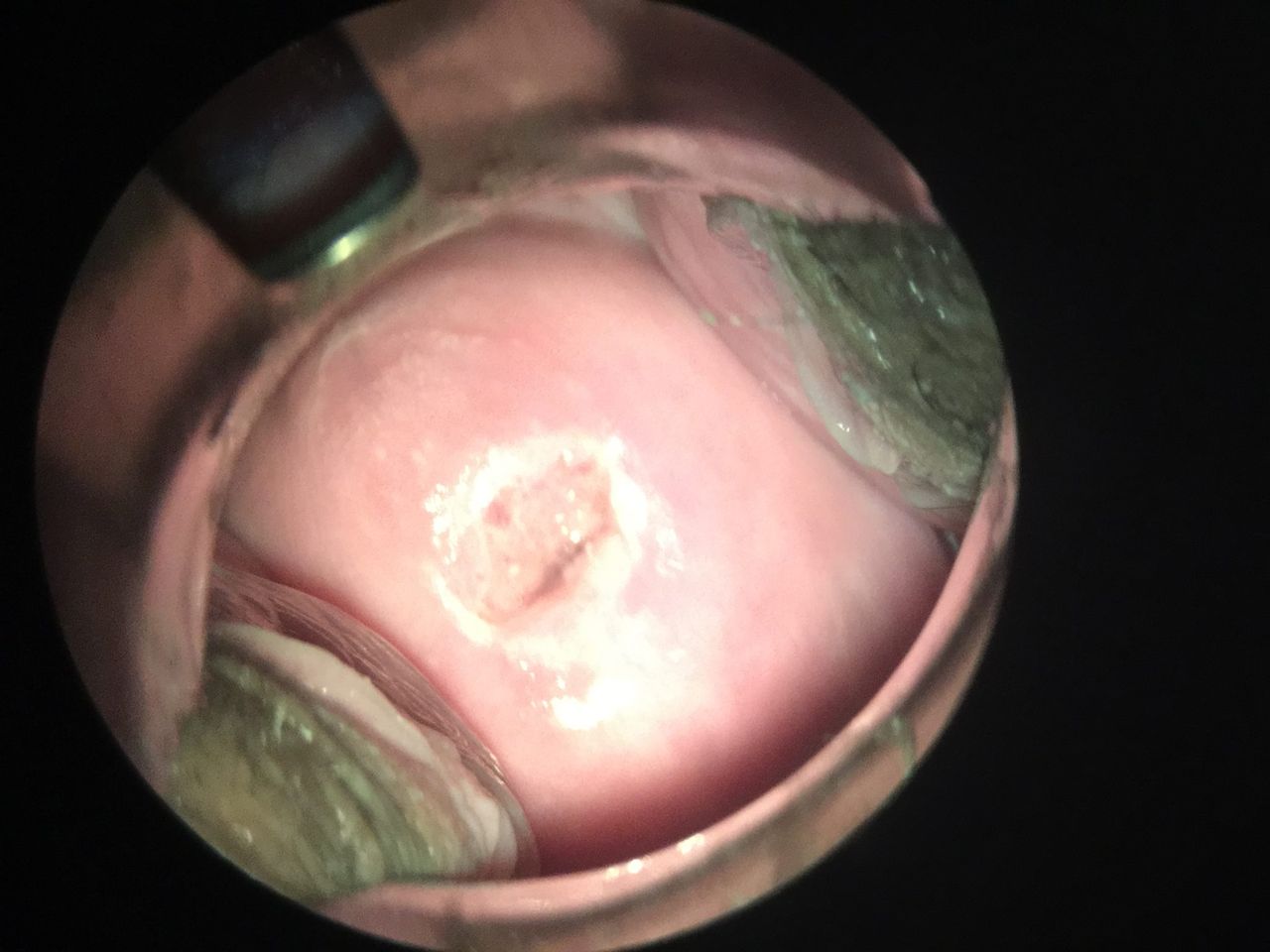 Imelda Zárate Fierro-7