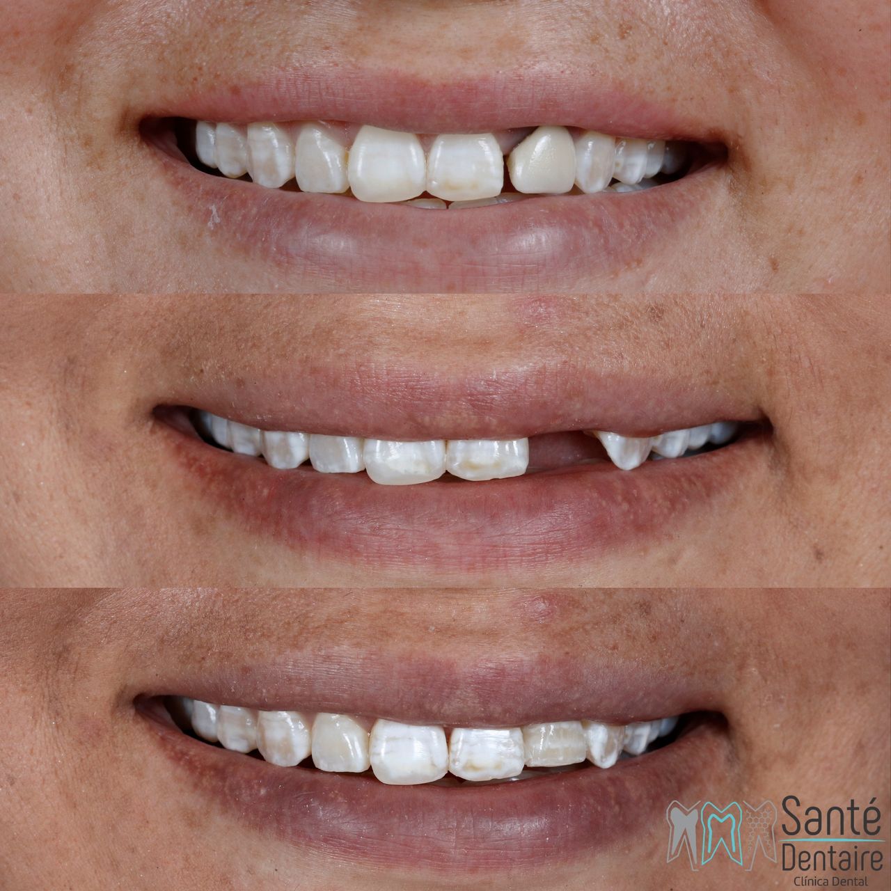 Daniel Oñate Robledo-23