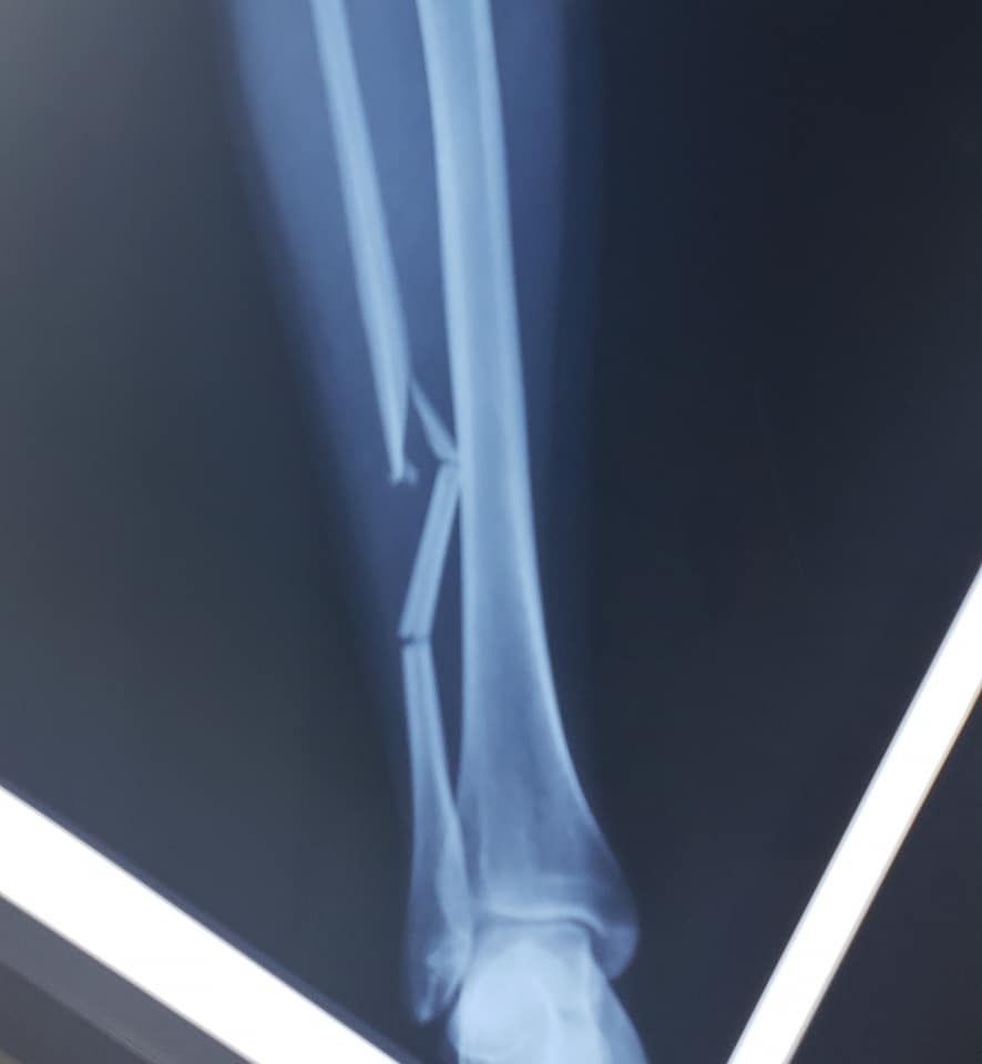 Juan Carlos Flores Raya-26