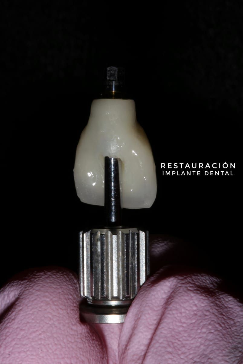 Hylse Najera Moya-14