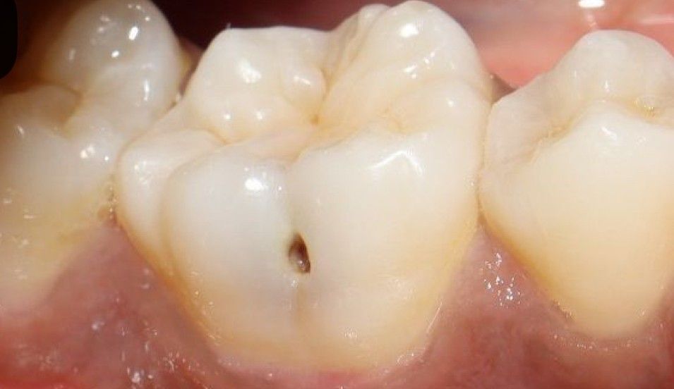 Esmeralda Candida Guerrero Pimentel-35