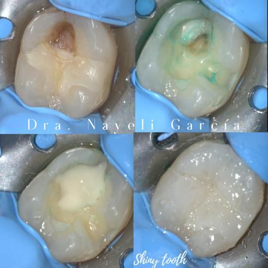 Nayeli Garcia Morales-27