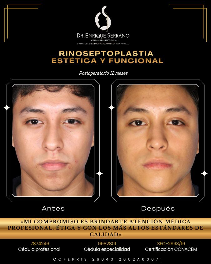 Enrique Serrano Cruz-4