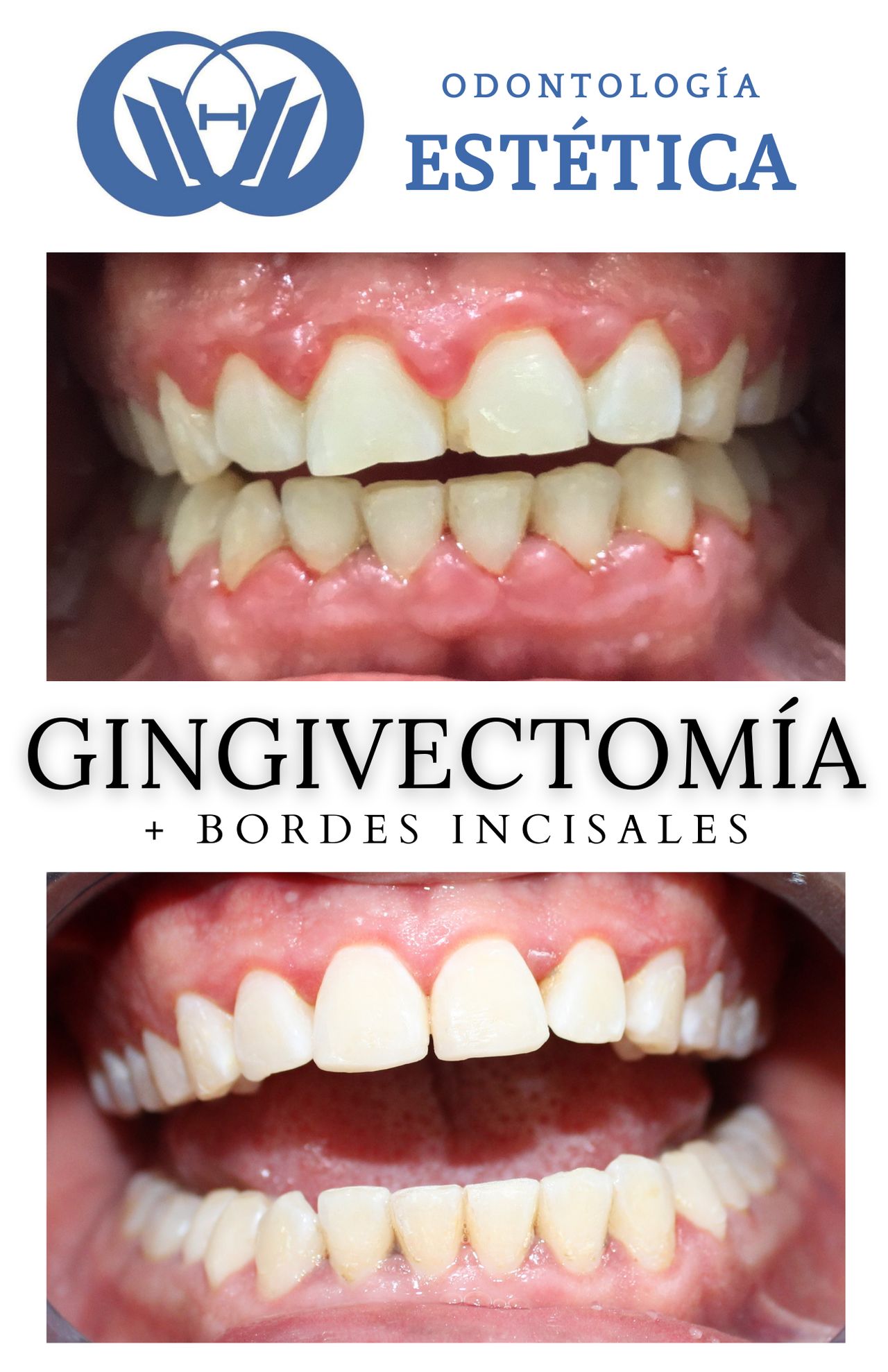 Verónica Olmedo Sánchez-8