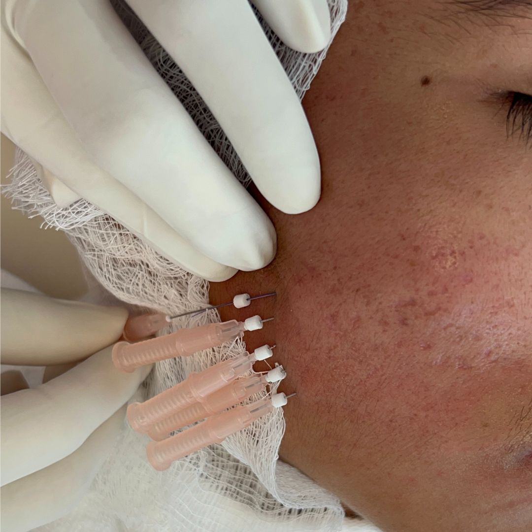 Laura Ortiz Lobato-8