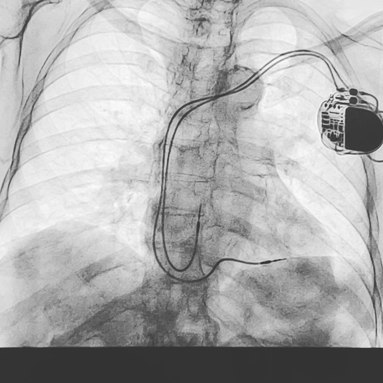 Oscar Alberto Ballesteros Vázquez-3