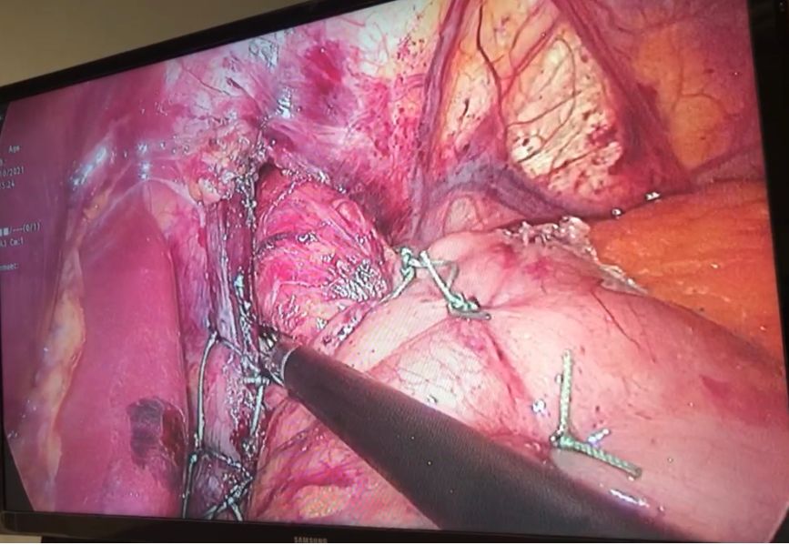 Juan Manuel Rangel Pizarro-10