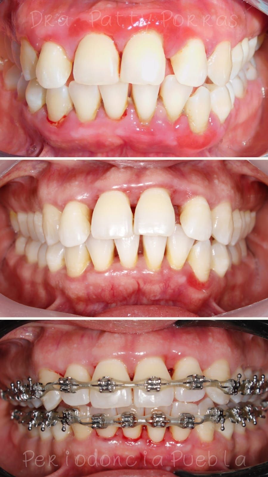 Patricia Porras Domínguez-11