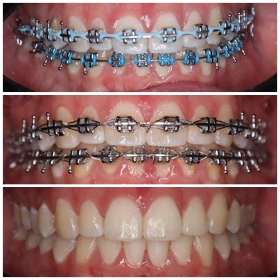 Victor Alejandro Mendoza Duron-1