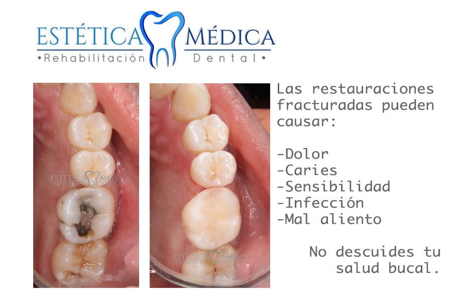 Bielmy Veronica Jonapa Peña-31