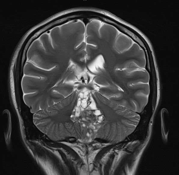 Marco Antonio Díaz Montoya-6