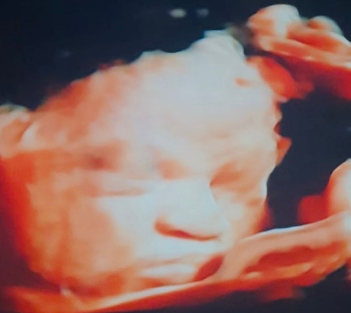 Brenda Lisset Briones Bernal-5