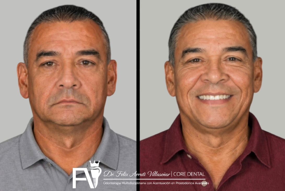 Félix Arruti Villaseñor-14