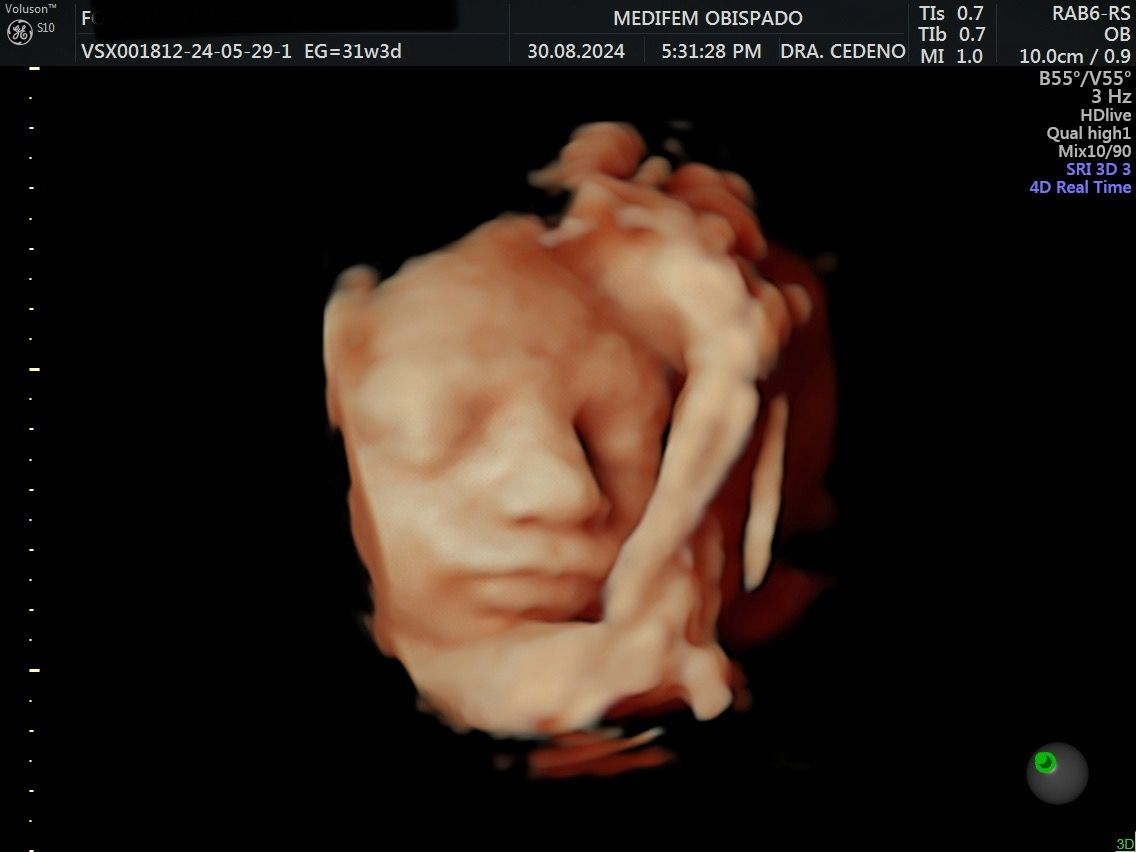 Victoria Margarita Cedeño Morales-2