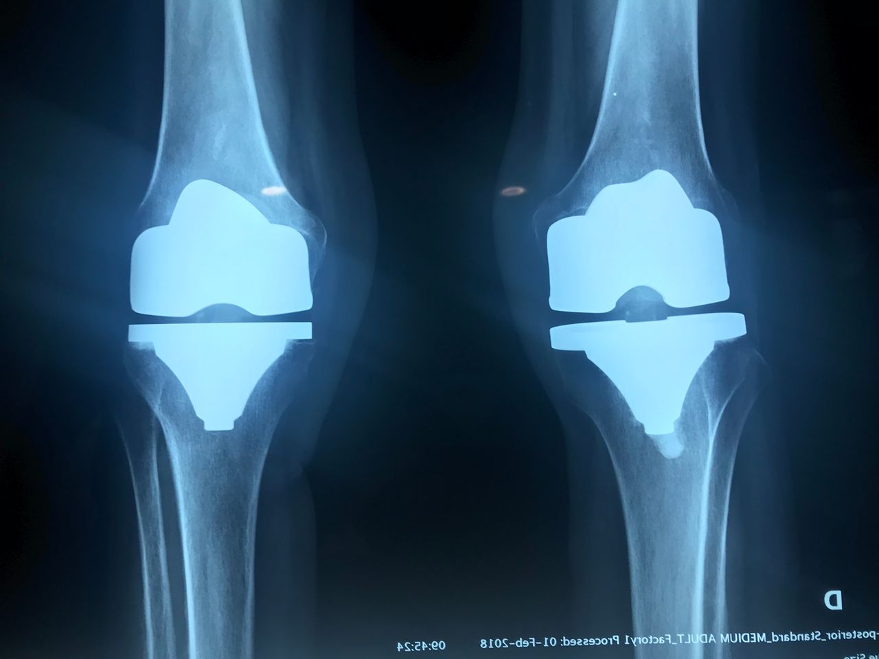 Victor Adrian López López-4