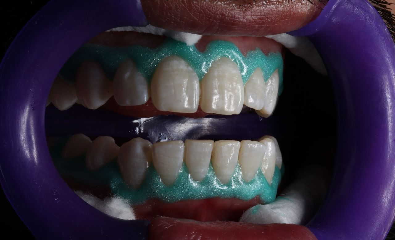 Oscar Alejandro Azcárate Tendilla-2