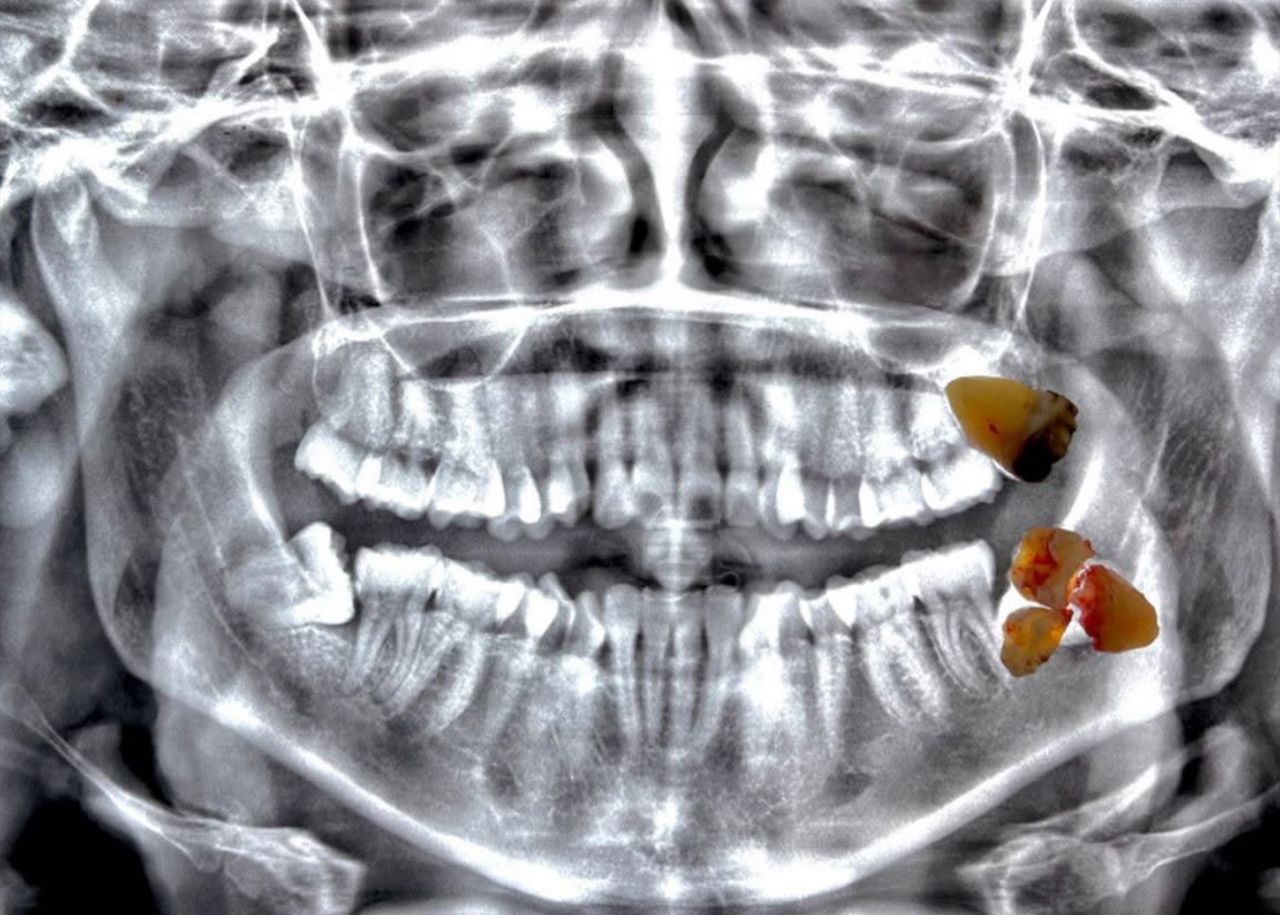 Ulises Alvarado Rodríguez-6