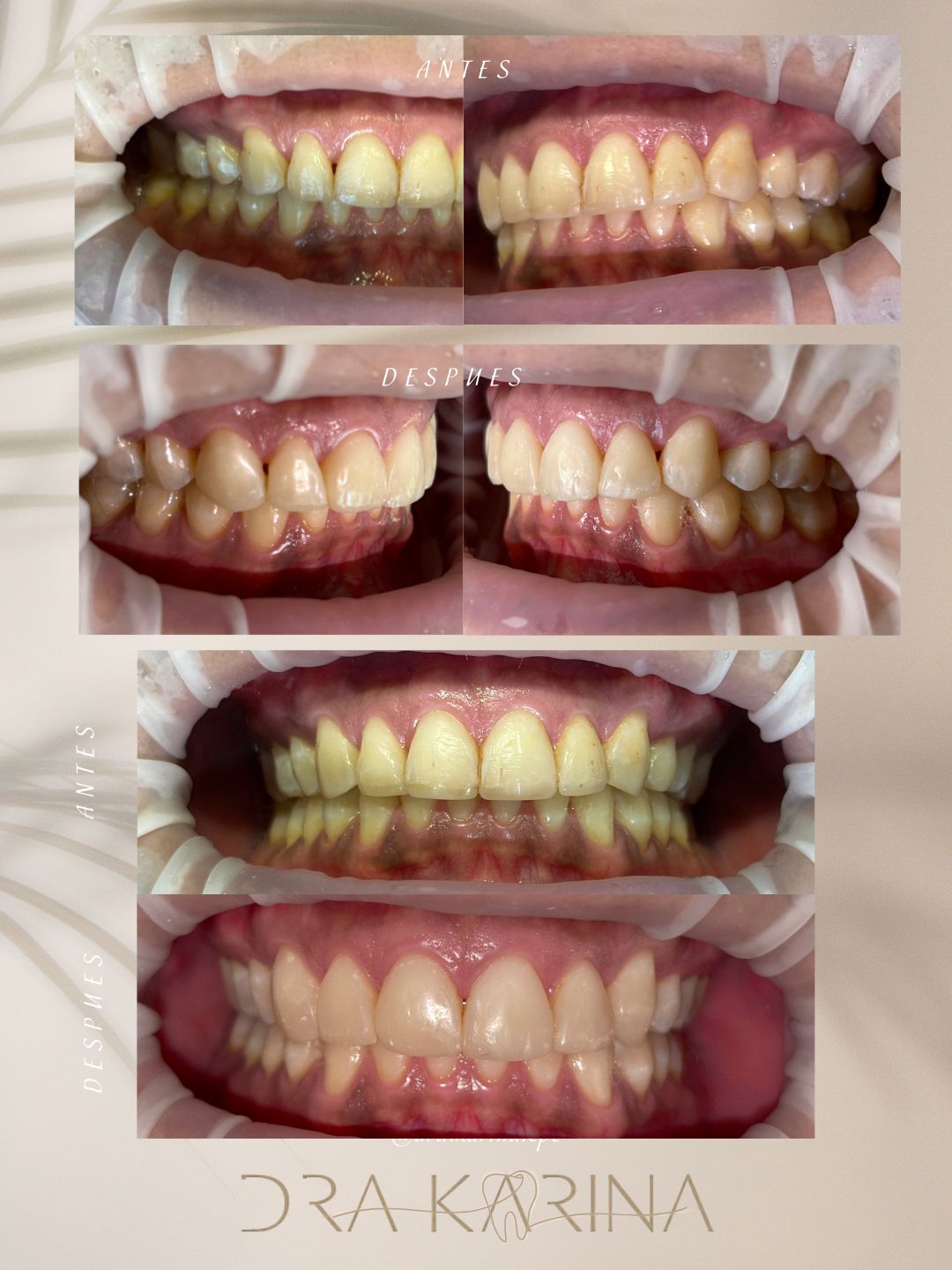 Karina Lepe Pedrajo-1