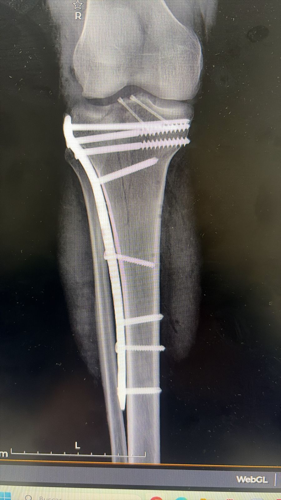 Alejandro Irisson-31