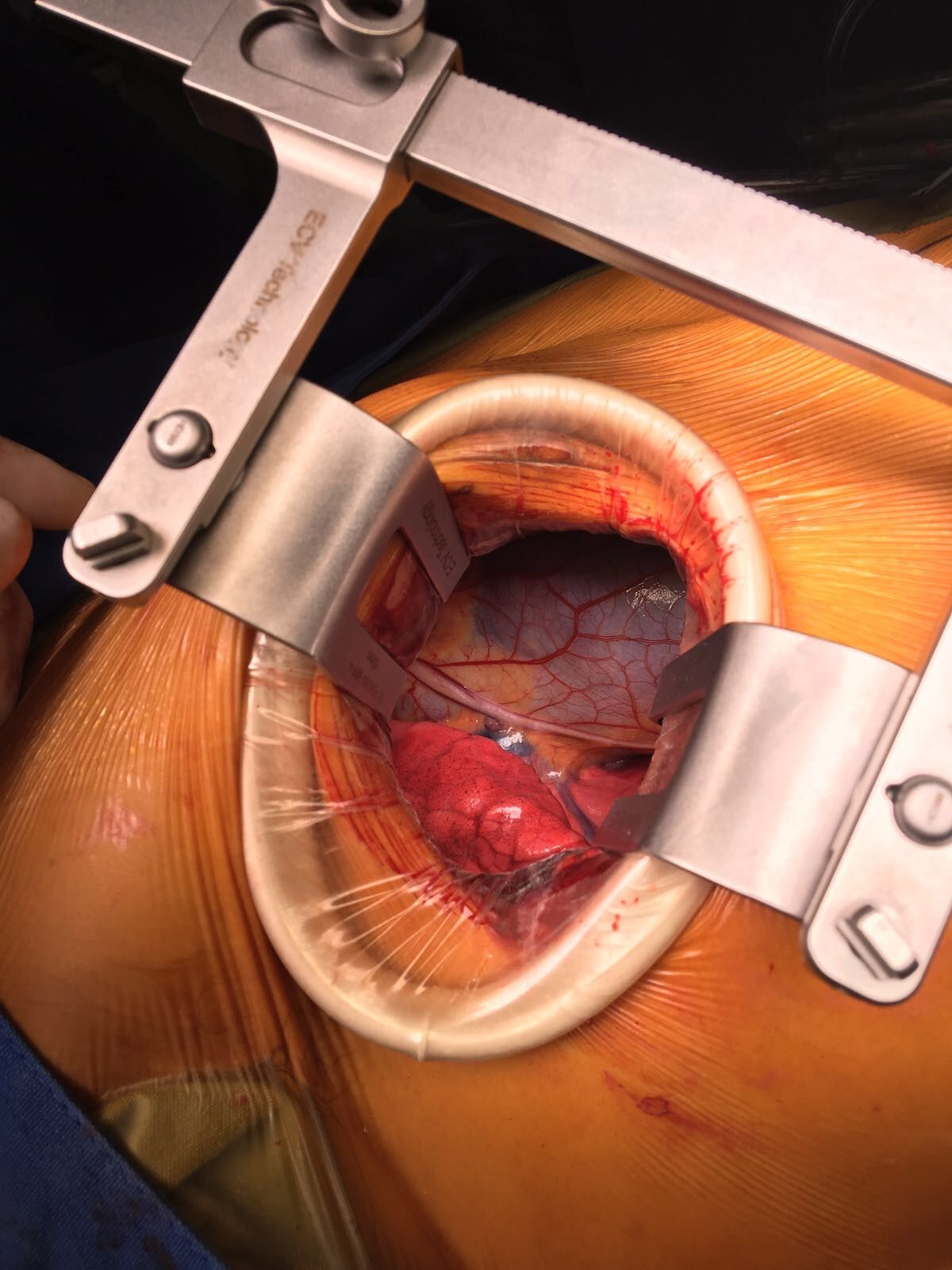 Luis Rubén Barragán Gárate-0