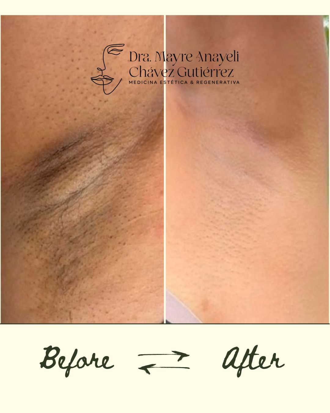 Mayre Anayeli Chávez Gutiérrez-2