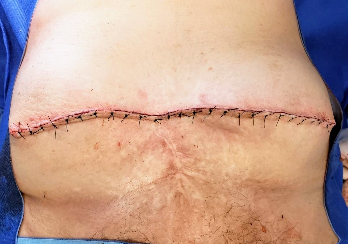 Luis Angel Medina Andrade-19