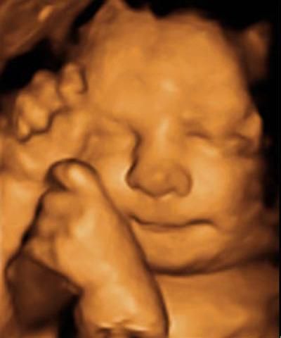 Araró Molina Coronel-5