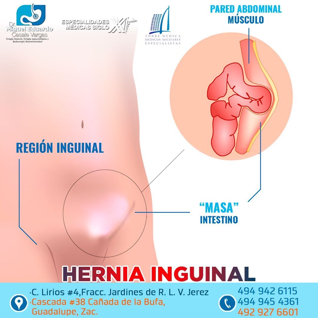 Miguel Eduardo Casale Vargas-21