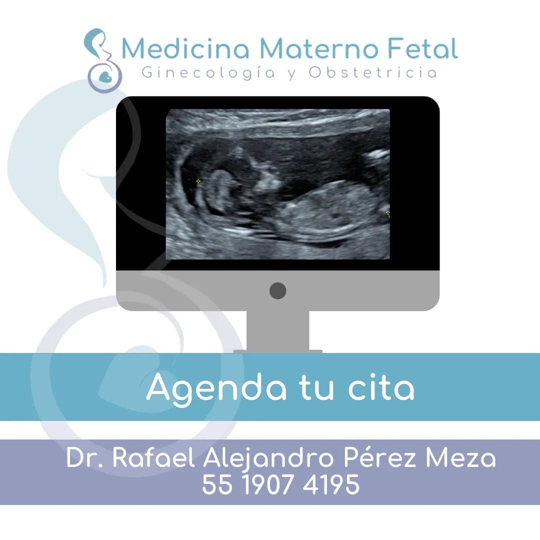 Rafael Alejandro Pérez Meza-10