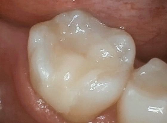 Ireri García Santana-12