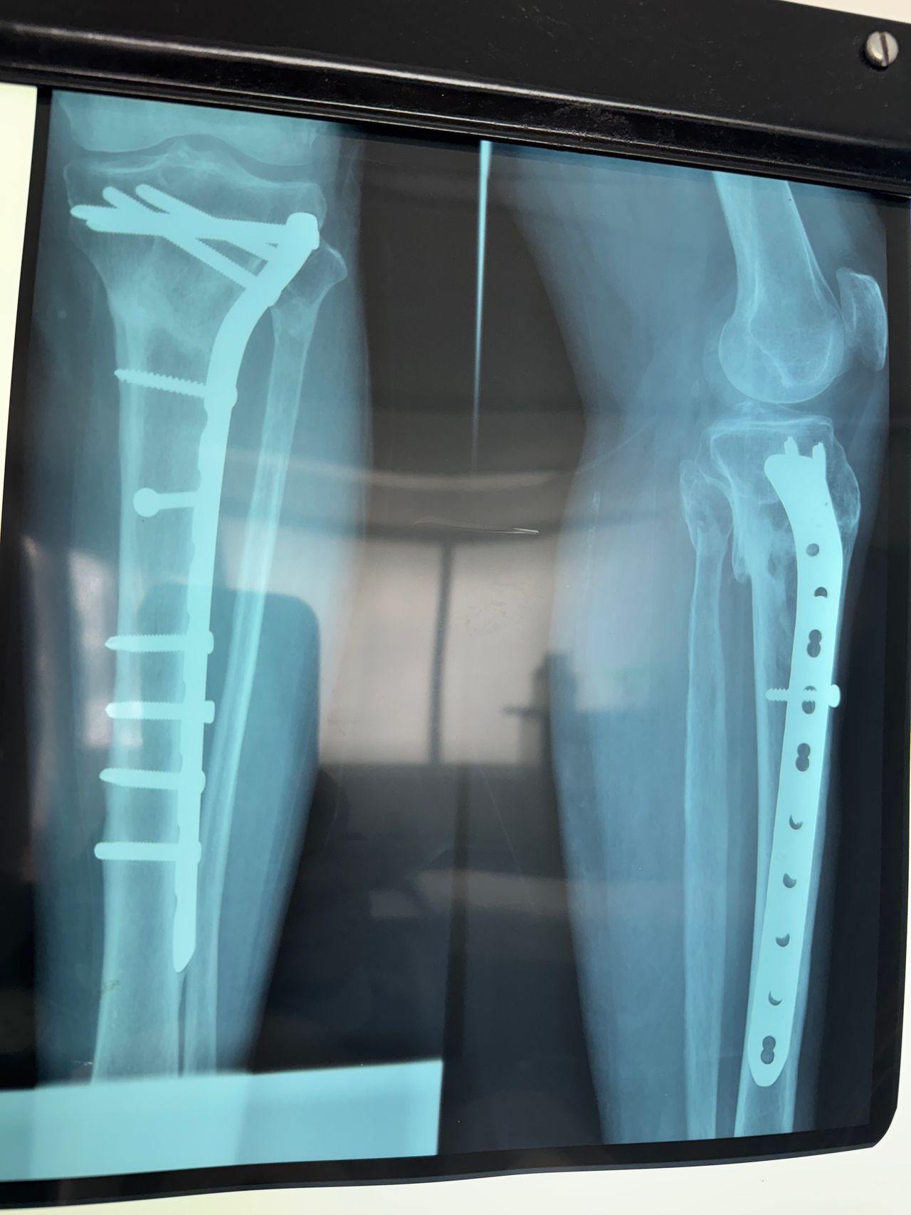 Max Georges Sainte Bernal-8