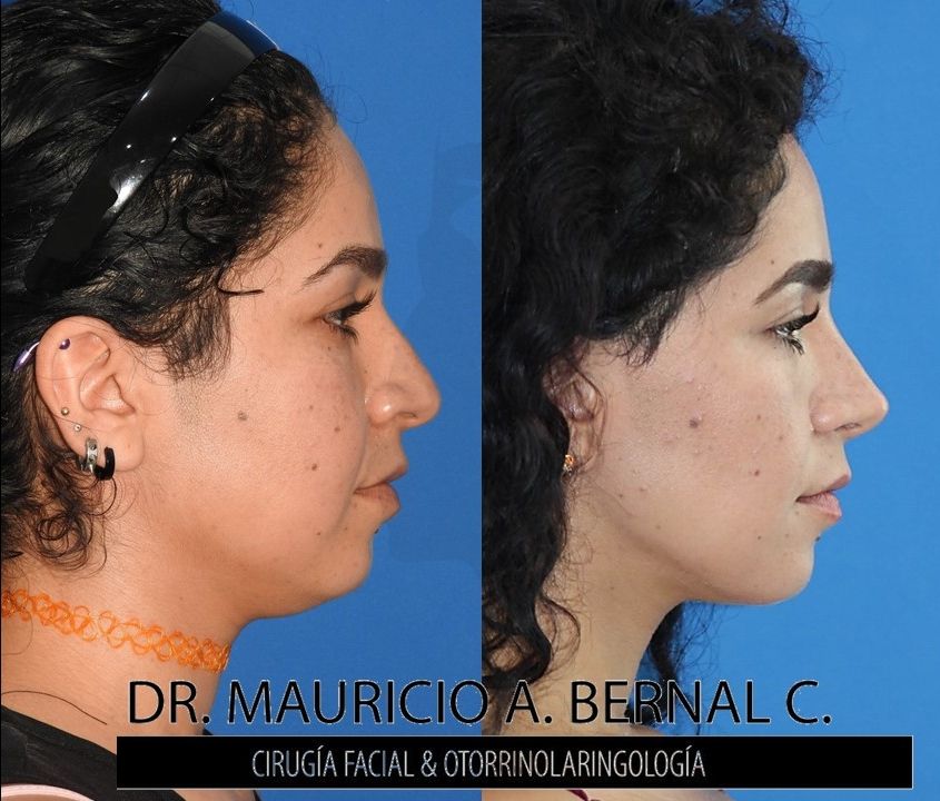 Mauricio Alejandro Bernal Carreon-5