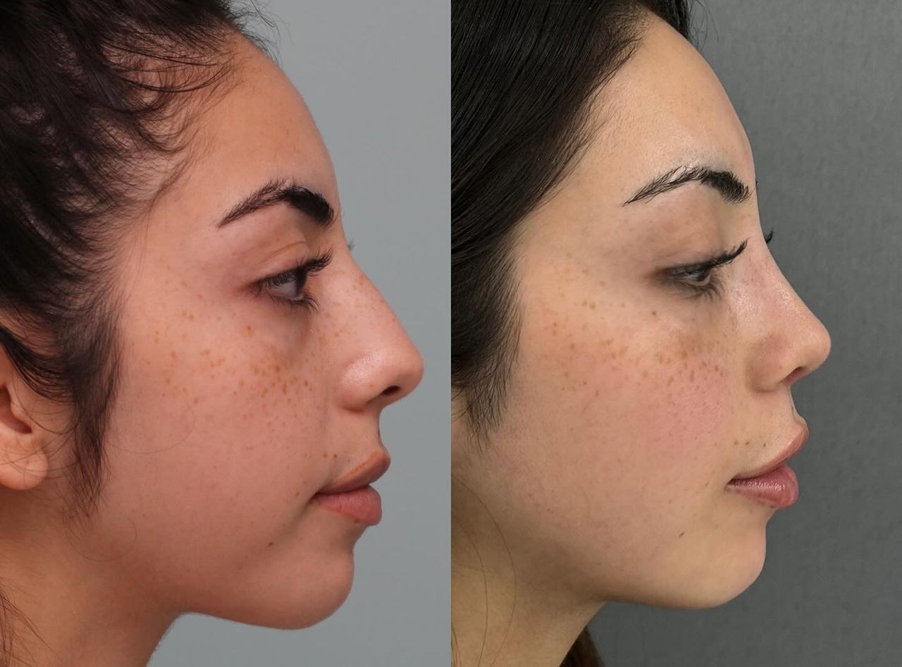 Angel Castro Urquizo-132