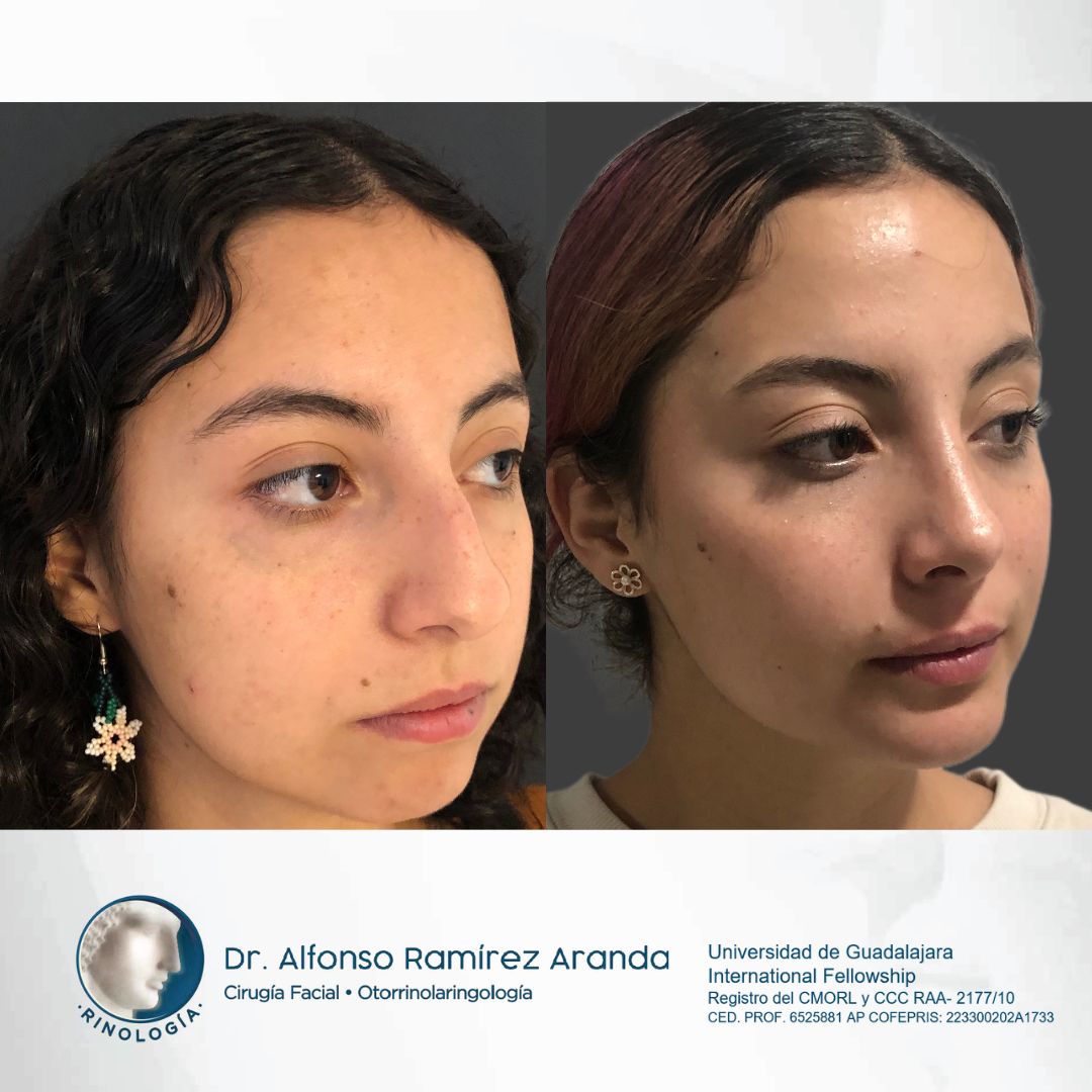 Alfonso Ramírez Aranda-13