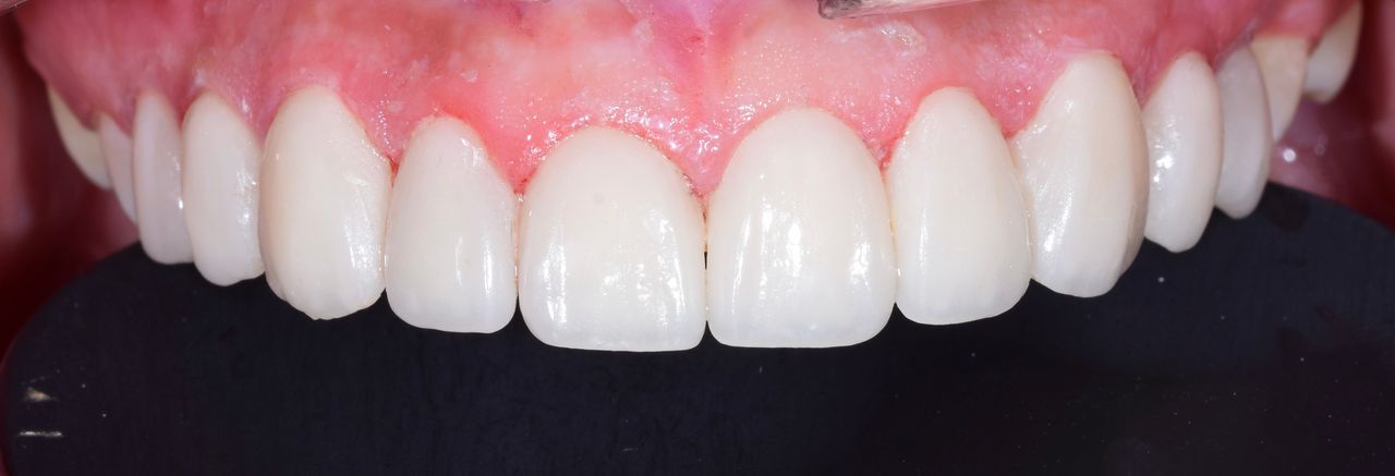 Adair Natanael Alvarez Castañeda-10