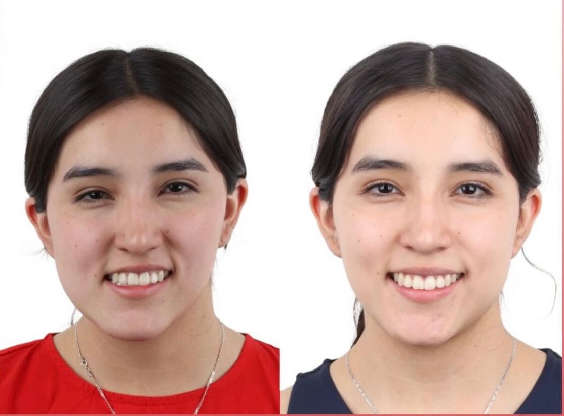 Nancy Valeria Lara Gayosso-6