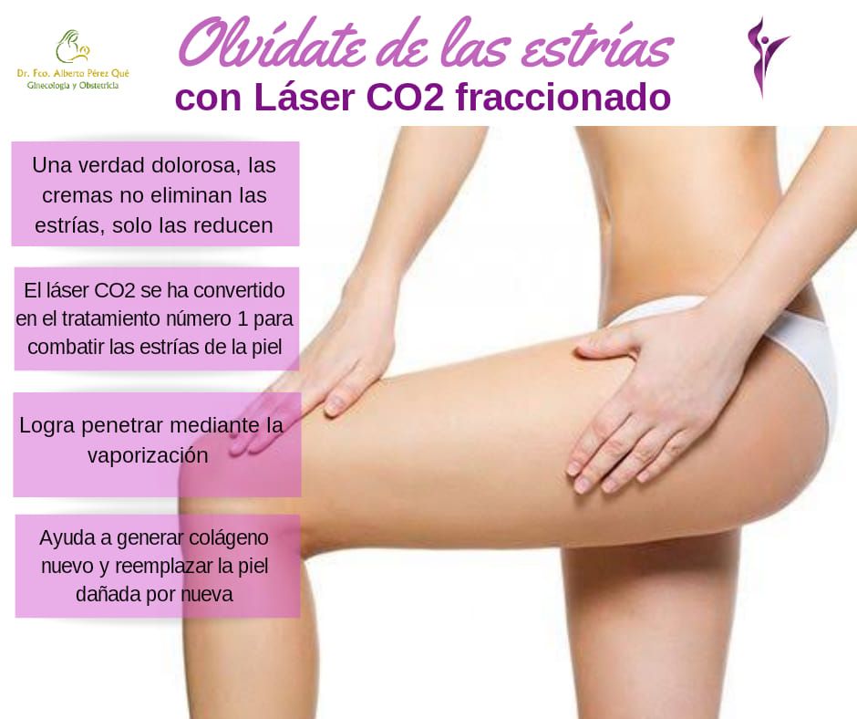 Francisco Alberto Perez Que-24