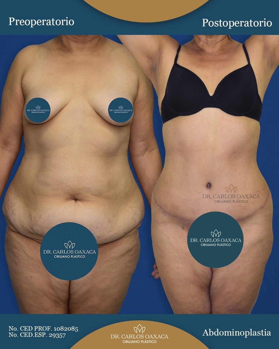 Carlos Guillermo Oaxaca Escobar-4