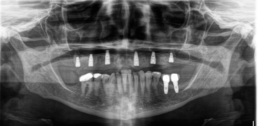 Ruben Arrieta Perez-1