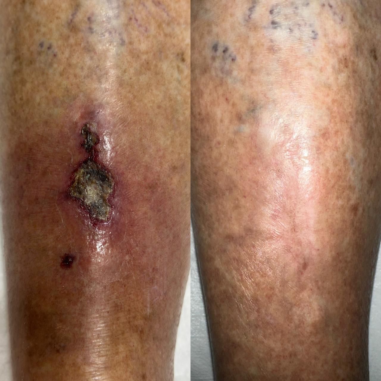 Jhonatan López González-58